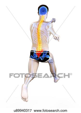 Stock Photo - Runner with back pain, conceptual illustration.. Fotosearch