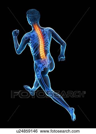 Runner with back pain, conceptual illustration. View Large Photo Image Stock Photograph - Runner with back pain, conceptual illustration.. Fotosearch