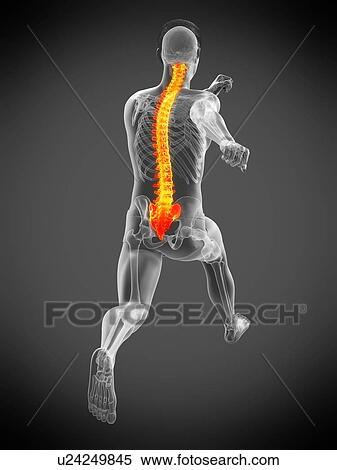 Stock Photography - Runner with back pain, conceptual illustration.. Fotosearch