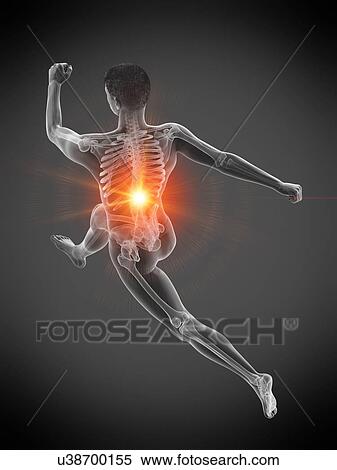 Runner with back pain, conceptual illustration. View Large Photo Image Stock Photography - Runner with back pain, conceptual illustration.. Fotosearch