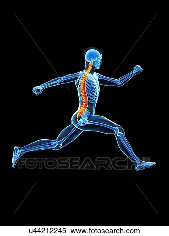 Stock Photography - Runner with back pain, conceptual illustration.. Fotosearch