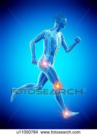 Runner with joint pain, conceptual illustration. View Large Photo Image Picture - Runner with joint pain, conceptual illustration.. Fotosearch