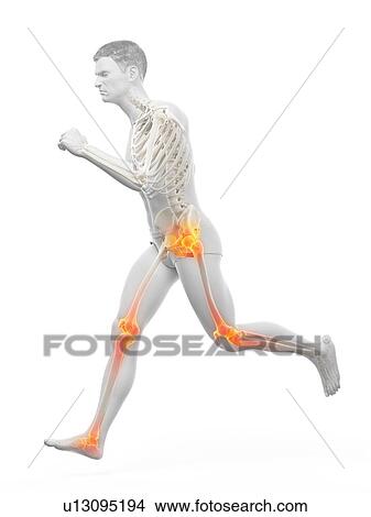 Runner with joint pain, conceptual illustration. View Large Photo Image Picture - Runner with joint pain, conceptual illustration.. Fotosearch
