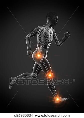 Runner with joint pain, conceptual illustration. View Large Photo Image Picture - Runner with joint pain, conceptual illustration.. Fotosearch