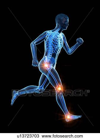 Runner with joint pain, conceptual illustration. View Large Photo Image Stock Image - Runner with joint pain, conceptual illustration.. Fotosearch