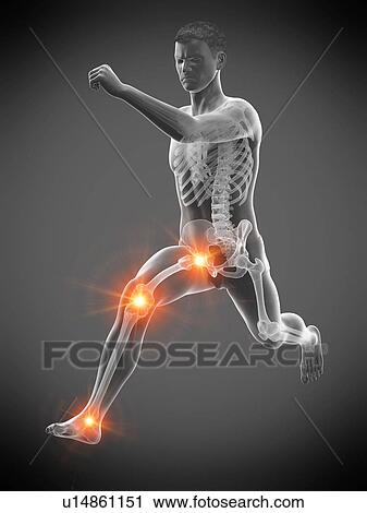 Runner with joint pain, conceptual illustration. View Large Photo Image Stock Image - Runner with joint pain, conceptual illustration.. Fotosearch