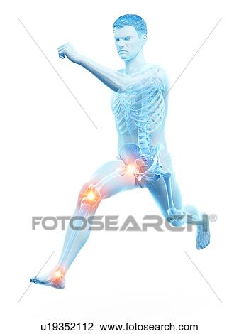 Stock Image - Runner with joint pain, conceptual illustration.. Fotosearch