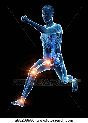 Runner with joint pain, conceptual illustration. View Large Photo Image Stock Image - Runner with joint pain, conceptual illustration.. Fotosearch