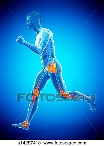 Stock Photo - Runner with joint pain, conceptual illustration.. Fotosearch