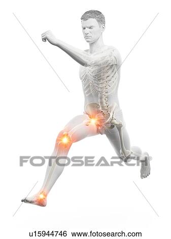 Runner with joint pain, conceptual illustration. View Large Photo Image Stock Photograph - Runner with joint pain, conceptual illustration.. Fotosearch