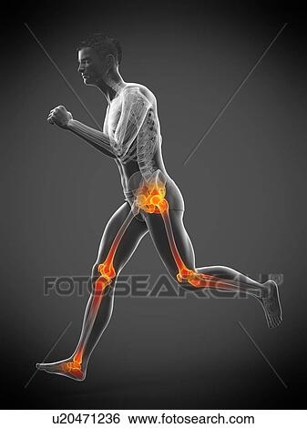 Stock Photograph - Runner with joint pain, conceptual illustration.. Fotosearch