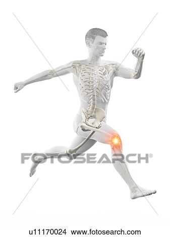 Picture - Runner with knee pain, conceptual illustration.. Fotosearch