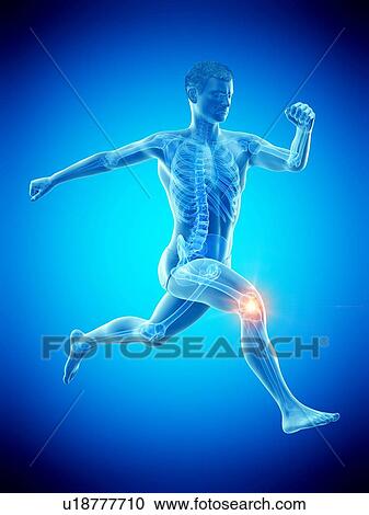 Runner with knee pain, conceptual illustration. View Large Photo Image Stock Image - Runner with knee pain, conceptual illustration.. Fotosearch