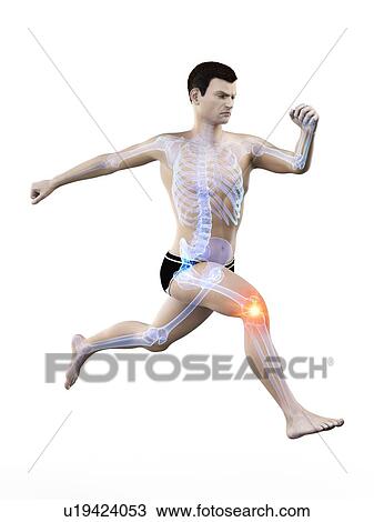 Runner with knee pain, conceptual illustration. View Large Photo Image Stock Image - Runner with knee pain, conceptual illustration.. Fotosearch