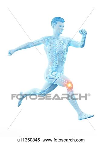 Runner with knee pain, conceptual illustration. View Large Photo Image Stock Photography - Runner with knee pain, conceptual illustration.. Fotosearch