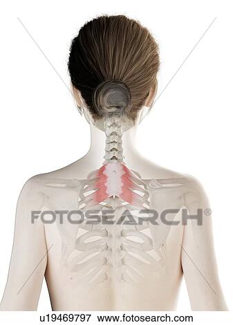 Stock Photo - Serratus posterior superior muscle, illustration. Fotosearch