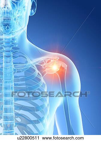 Shoulder pain, conceptual computer illustration. View Large Photo Image Stock Image - Shoulder pain, conceptual computer illustration.. Fotosearch