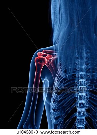 Stock Image - Shoulder pain, conceptual illustration. Fotosearch