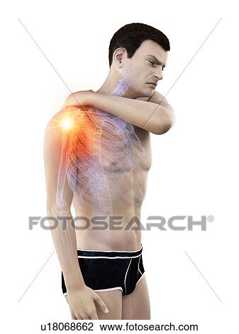 Stock Image - Shoulder pain, conceptual illustration.. Fotosearch