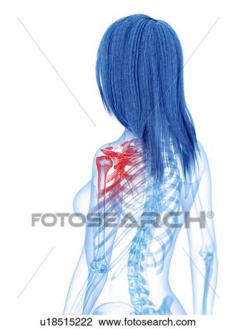 Stock Image - Shoulder pain, conceptual illustration. Fotosearch