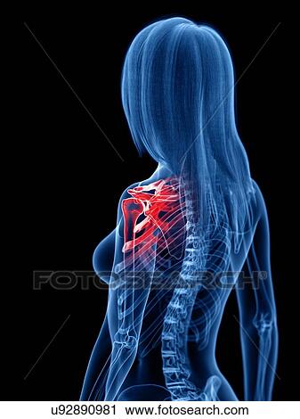 Stock Image - Shoulder pain, conceptual illustration. Fotosearch