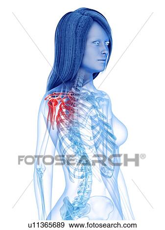 Stock Photo - Shoulder pain, conceptual illustration. Fotosearch