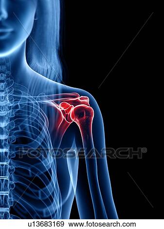 Stock Photo - Shoulder pain, conceptual illustration. Fotosearch