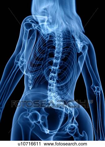 Stock Image - Skeleton, illustration. Fotosearch