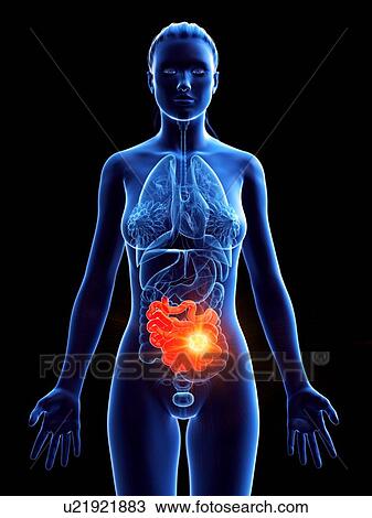 Small intestine, computer illustration. cancer View Large Photo Image Stock Image - Small intestine, computer illustration. cancer. Fotosearch