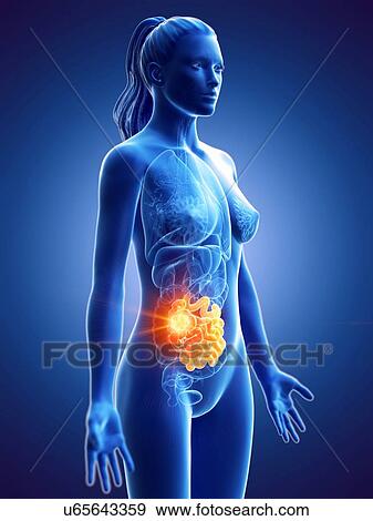 Stock Photo - Small intestine, computer illustration. cancer. Fotosearch