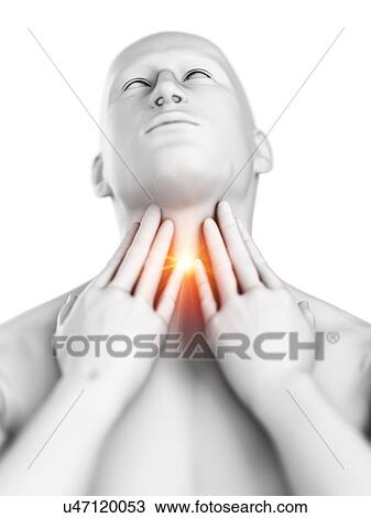 Stock Image - Sore throat, conceptual computer illustration.. Fotosearch