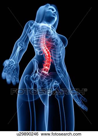 Spine pain, conceptual illustration View Large Photo Image Stock Photograph - Spine pain, conceptual illustration. Fotosearch