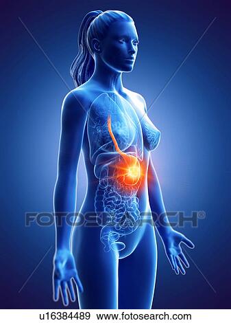 Stomach cancer, conceptual computer illustration. View Large Photo Image Stock Photo - Stomach cancer, conceptual computer illustration.. Fotosearch