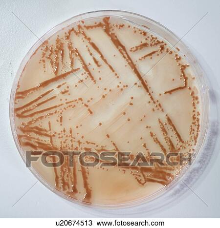 Stool culture. View Large Photo Image Stock Image - Stool culture.. Fotosearch