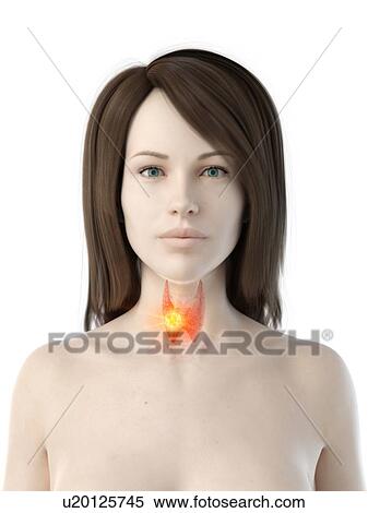 Stock Photography - Thyroid cancer, conceptual illustration. Fotosearch