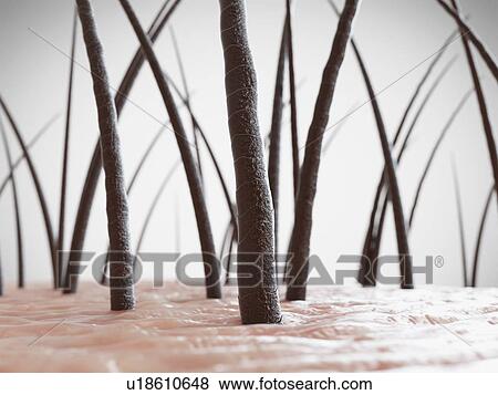 Stock Photo - Unhealthy human hair, computer illustration.. Fotosearch