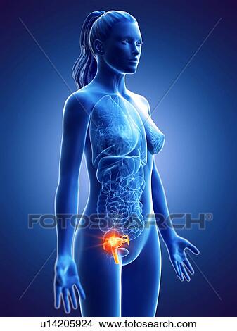Picture - Uterine cancer, conceptual computer illustration.. Fotosearch