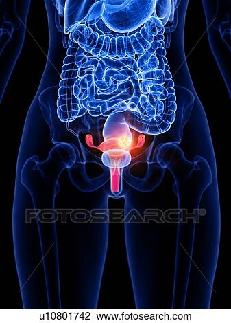 Stock Image - Uterine cancer, conceptual illustration. Fotosearch