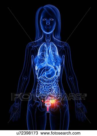 Uterine cancer, conceptual illustration View Large Photo Image Stock Image - Uterine cancer, conceptual illustration. Fotosearch
