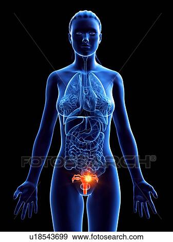Uterus, computer illustration. cancer View Large Photo Image Stock Photo - Uterus, computer illustration. cancer. Fotosearch
