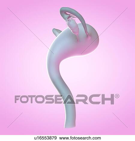 Stock Photo - Uterus, computer illustration.. Fotosearch