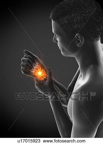 Wrist pain, conceptual illustration. View Large Photo Image Stock Image - Wrist pain, conceptual illustration.. Fotosearch