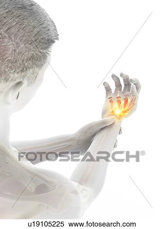 Wrist pain, conceptual illustration. View Large Photo Image Stock Photography - Wrist pain, conceptual illustration.. Fotosearch