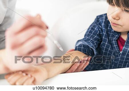 Stock Image - Allergy skin prick testing. Fotosearch