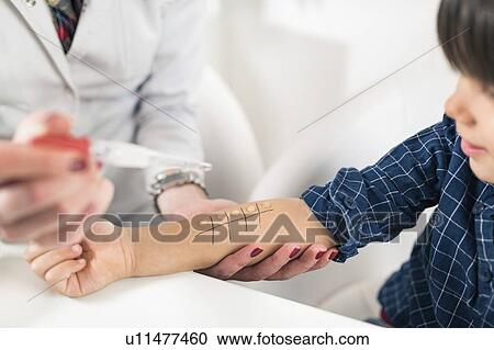 Stock Image - Allergy skin prick testing. Fotosearch