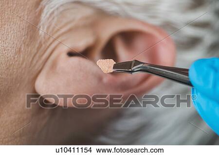 Picture - Auricular therapy. Fotosearch