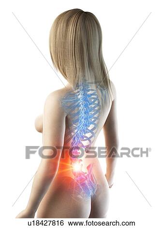 Back pain, conceptual illustration View Large Photo Image Stock Photograph - Back pain, conceptual illustration. Fotosearch