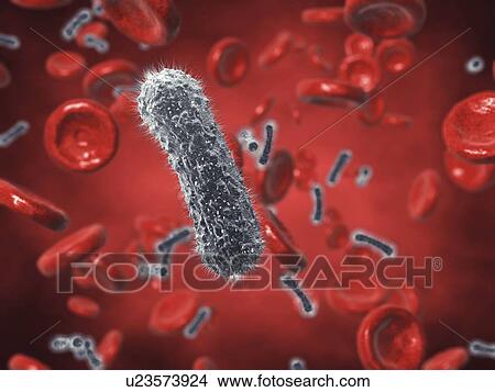 Picture - Bacterial infection, illustration. Fotosearch