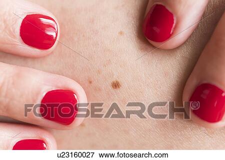 Close-up of woman wearing red nail polish touching skin with freckle View Large Photo Image Stock Photo - Close-up of woman wearing red nail polish touching skin with freckle. Fotosearch