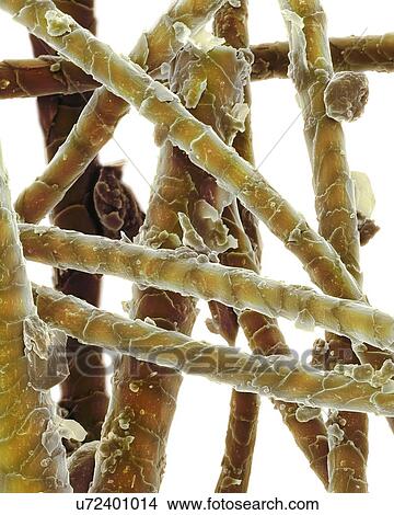 Picture - Dander on dog hair, SEM. Fotosearch